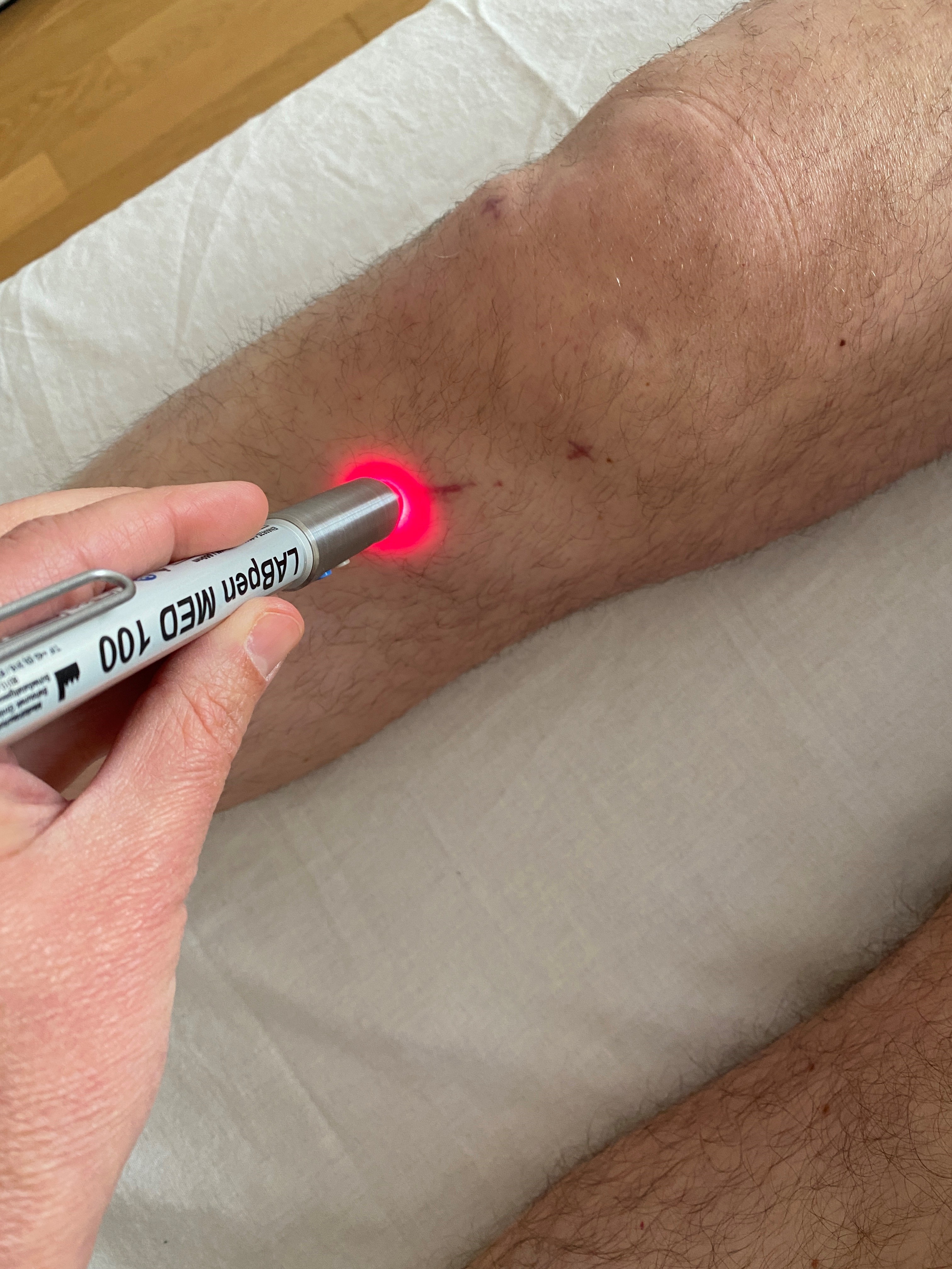 Bild Laseranwendung an Knie